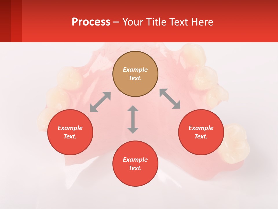 A Dental Model With Teeth And Gums On A White Background PowerPoint Template
