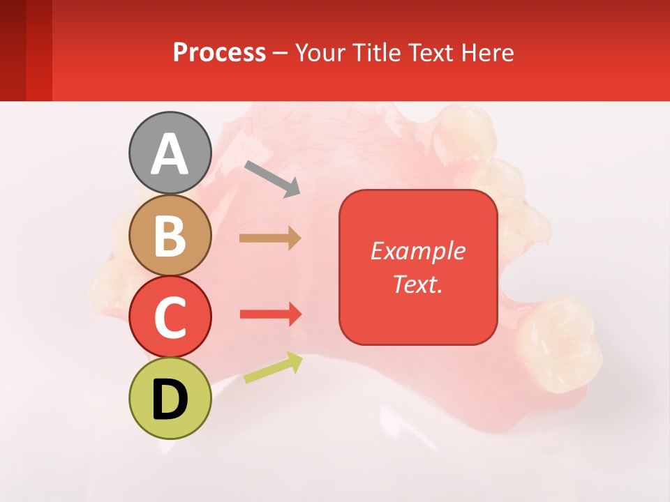 A Dental Model With Teeth And Gums On A White Background PowerPoint Template