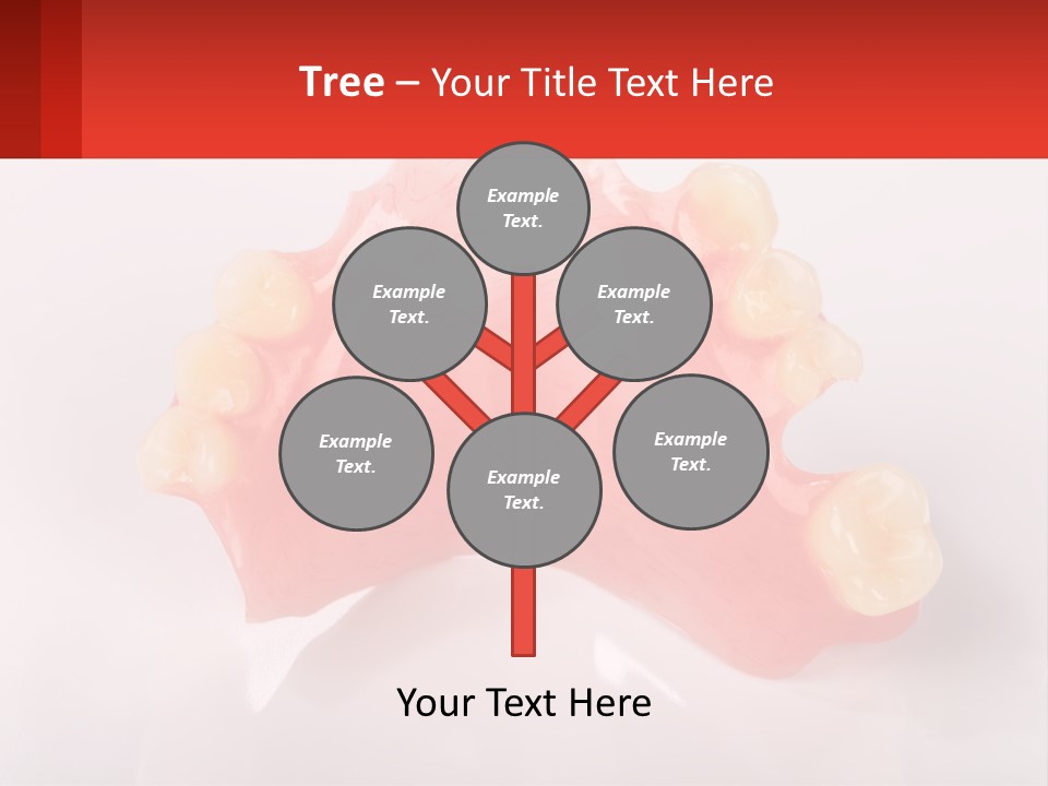 A Dental Model With Teeth And Gums On A White Background PowerPoint Template