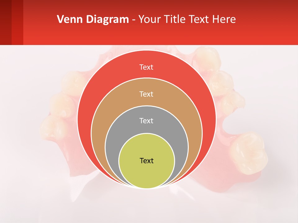 A Dental Model With Teeth And Gums On A White Background PowerPoint Template