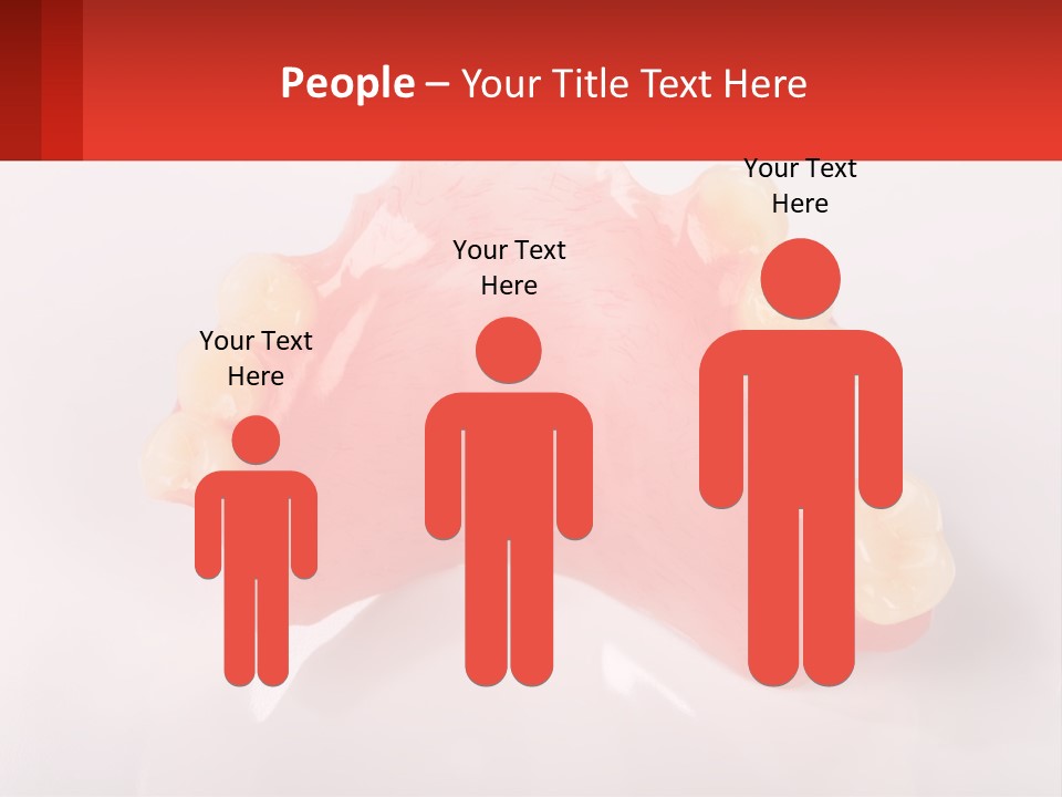A Dental Model With Teeth And Gums On A White Background PowerPoint Template