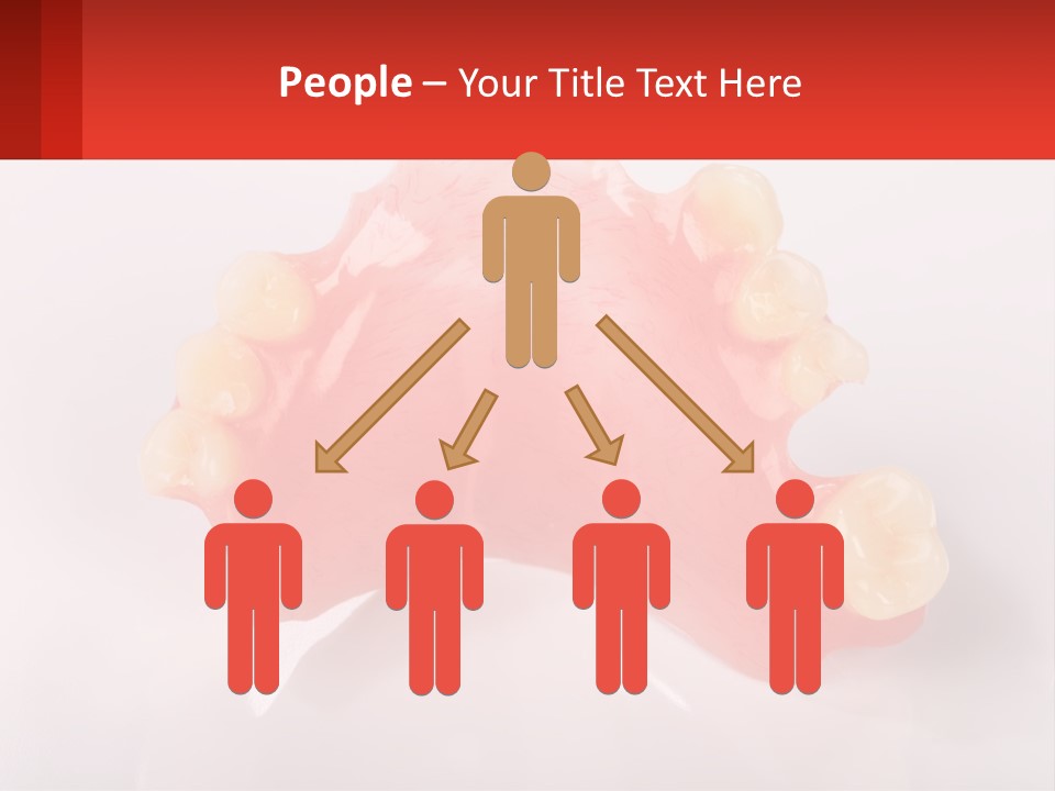 A Dental Model With Teeth And Gums On A White Background PowerPoint Template