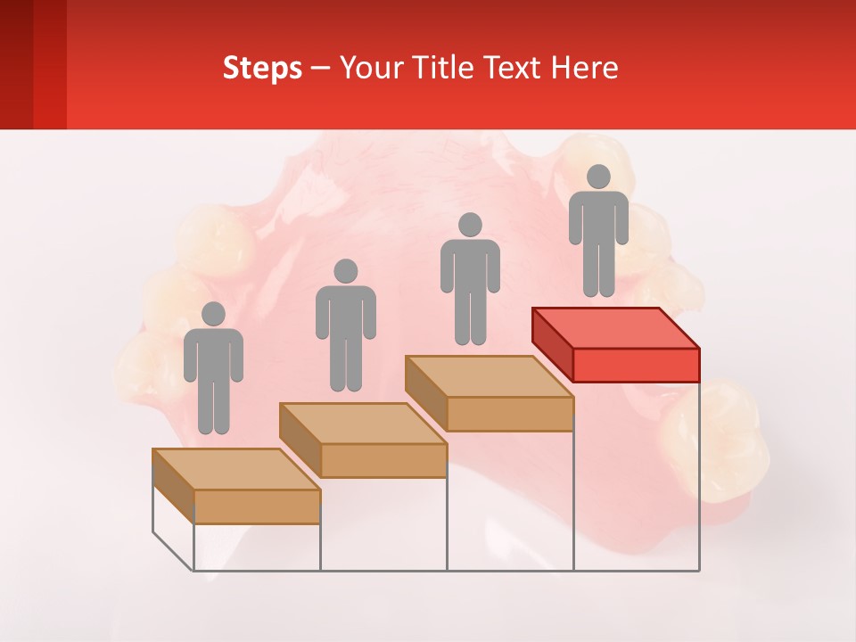 A Dental Model With Teeth And Gums On A White Background PowerPoint Template