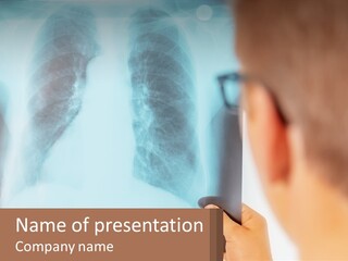 A Man Looking At A X - Ray Of A Lung PowerPoint Template