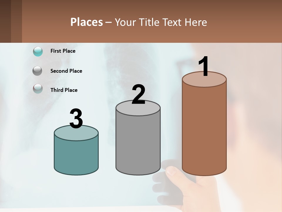 A Man Looking At A X - Ray Of A Lung PowerPoint Template