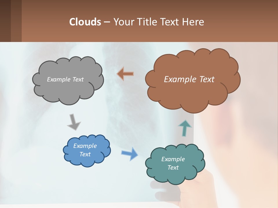 A Man Looking At A X - Ray Of A Lung PowerPoint Template