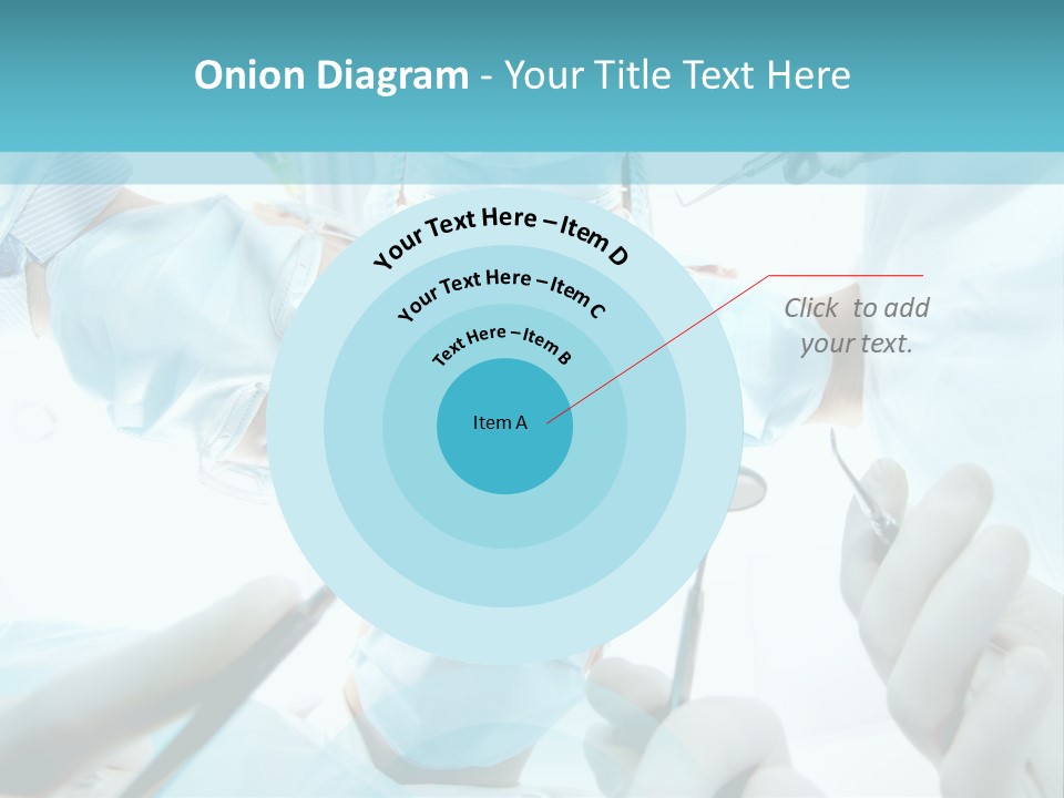 A Group Of Surgeons In A Operating Room PowerPoint Template