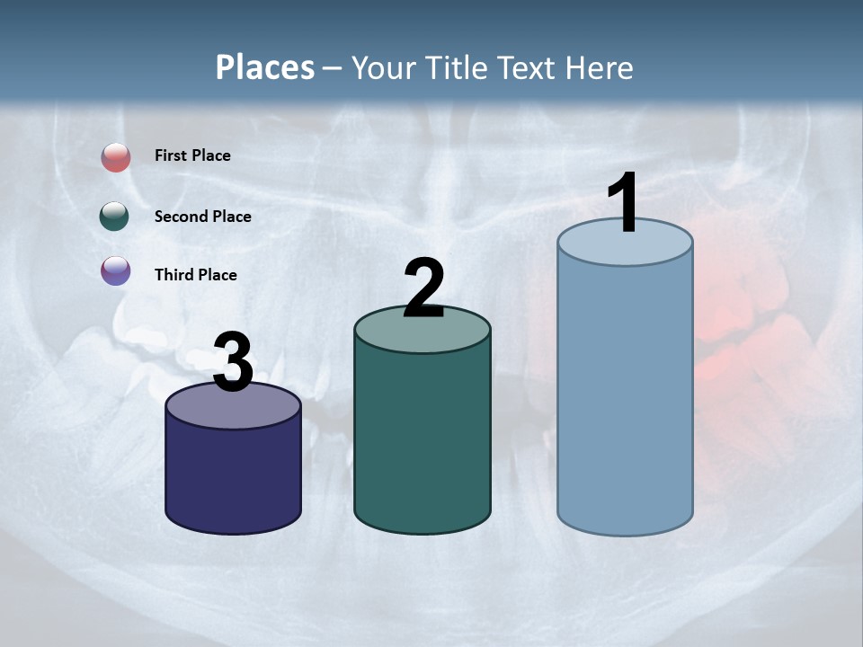 An X - Ray Of A Man's Teeth With A Red Spot In The PowerPoint Template