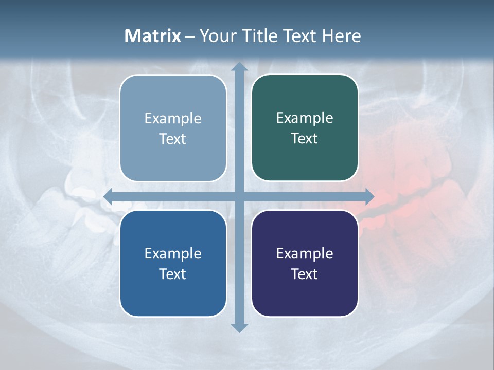 An X - Ray Of A Man's Teeth With A Red Spot In The PowerPoint Template