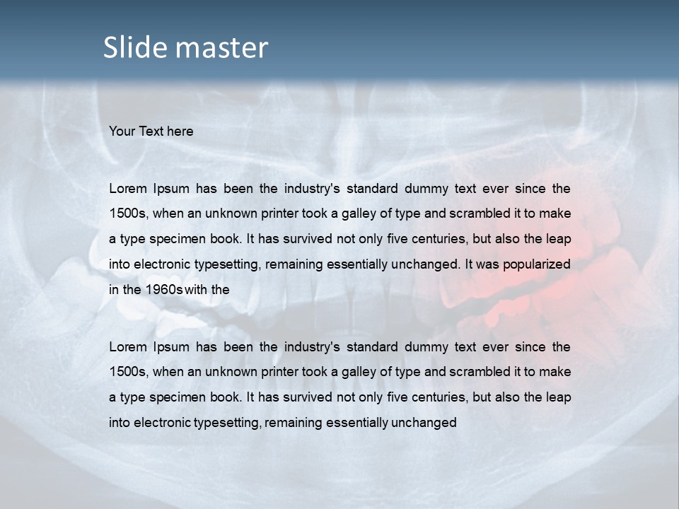 An X - Ray Of A Man's Teeth With A Red Spot In The PowerPoint Template