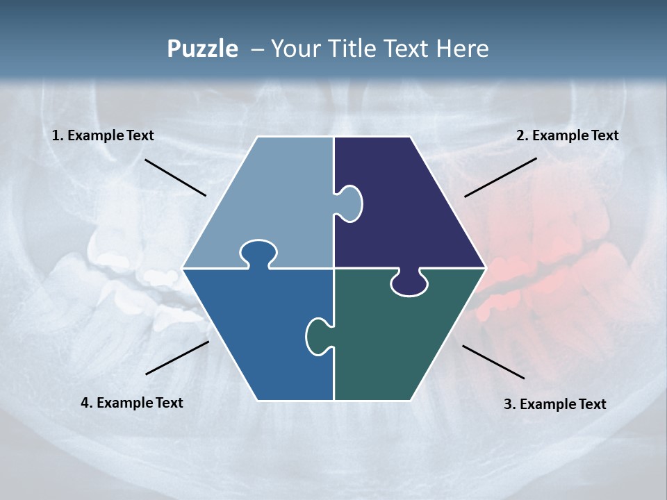 An X - Ray Of A Man's Teeth With A Red Spot In The PowerPoint Template