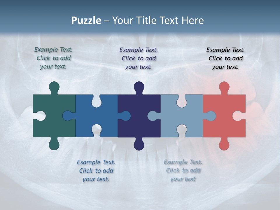 An X - Ray Of A Man's Teeth With A Red Spot In The PowerPoint Template