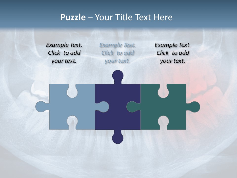 An X - Ray Of A Man's Teeth With A Red Spot In The PowerPoint Template