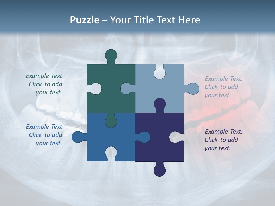 An X - Ray Of A Man's Teeth With A Red Spot In The PowerPoint Template