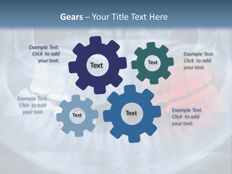An X - Ray Of A Man's Teeth With A Red Spot In The PowerPoint Template