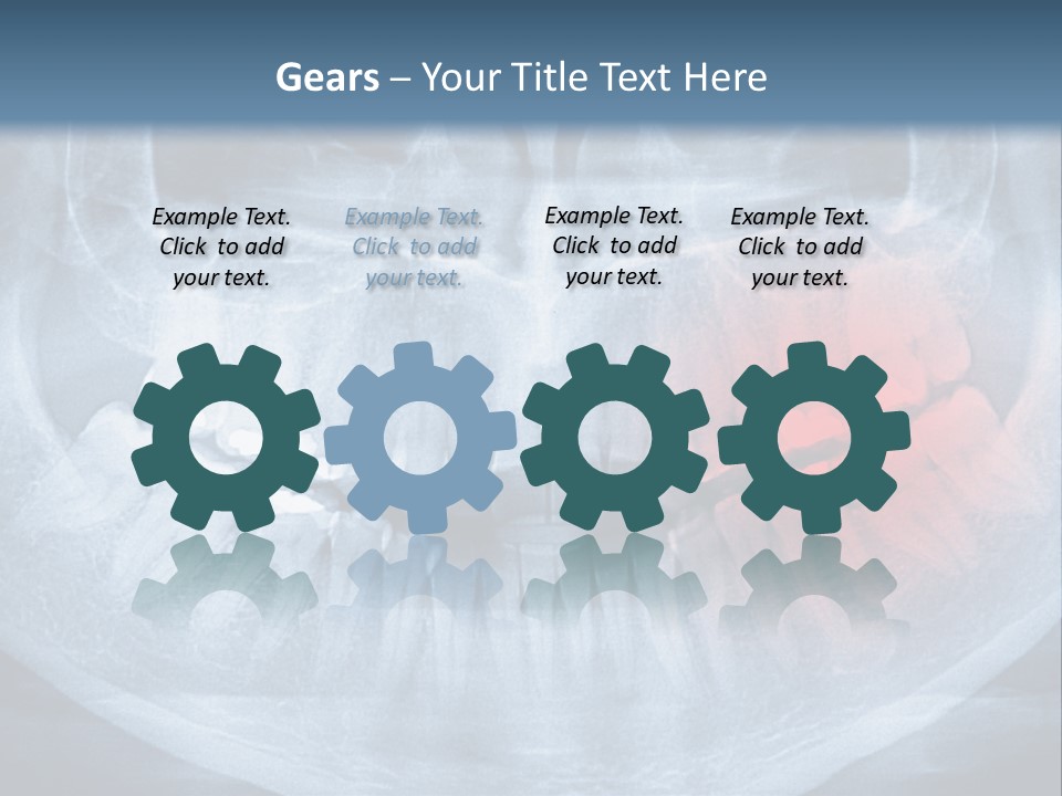 An X - Ray Of A Man's Teeth With A Red Spot In The PowerPoint Template