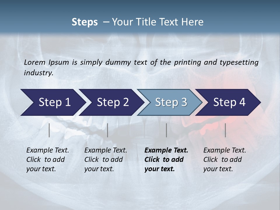 An X - Ray Of A Man's Teeth With A Red Spot In The PowerPoint Template
