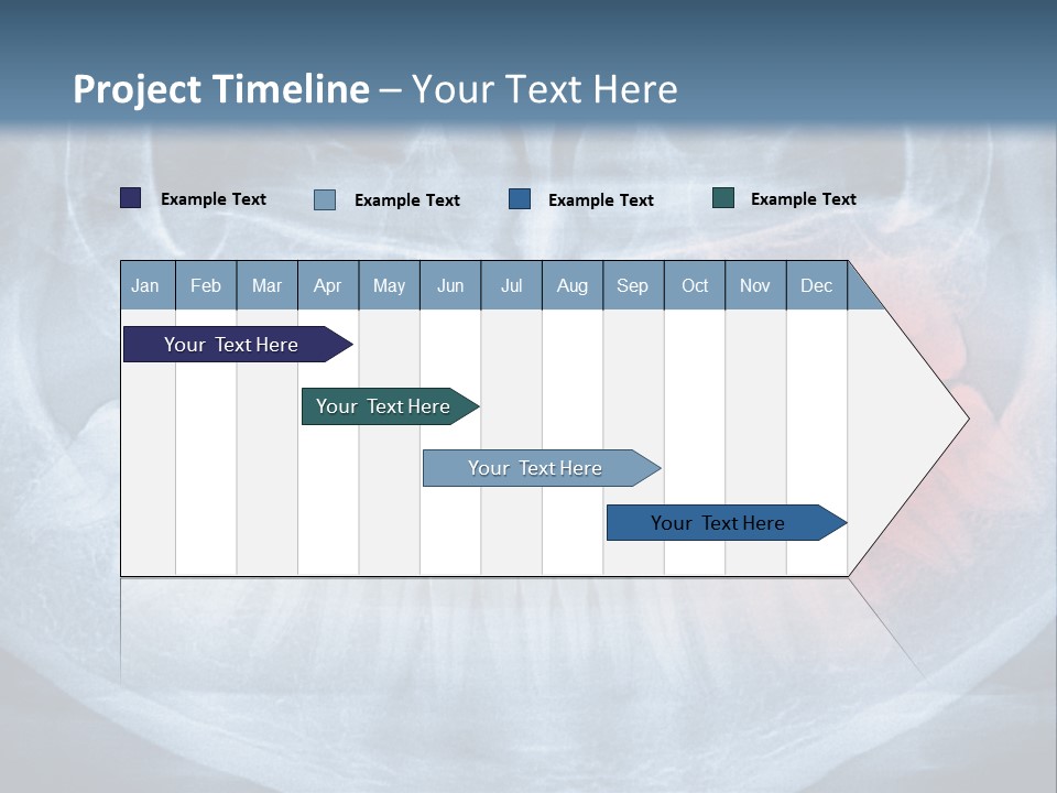 An X - Ray Of A Man's Teeth With A Red Spot In The PowerPoint Template