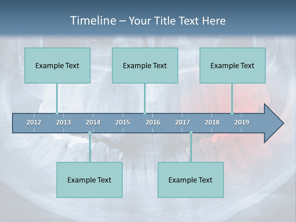 An X - Ray Of A Man's Teeth With A Red Spot In The PowerPoint Template