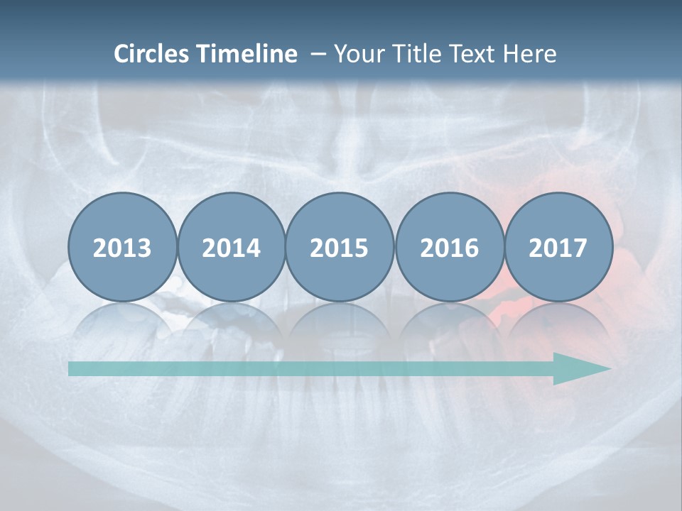 An X - Ray Of A Man's Teeth With A Red Spot In The PowerPoint Template