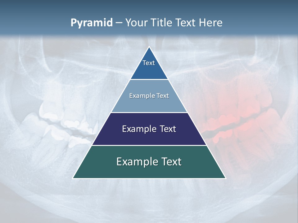 An X - Ray Of A Man's Teeth With A Red Spot In The PowerPoint Template