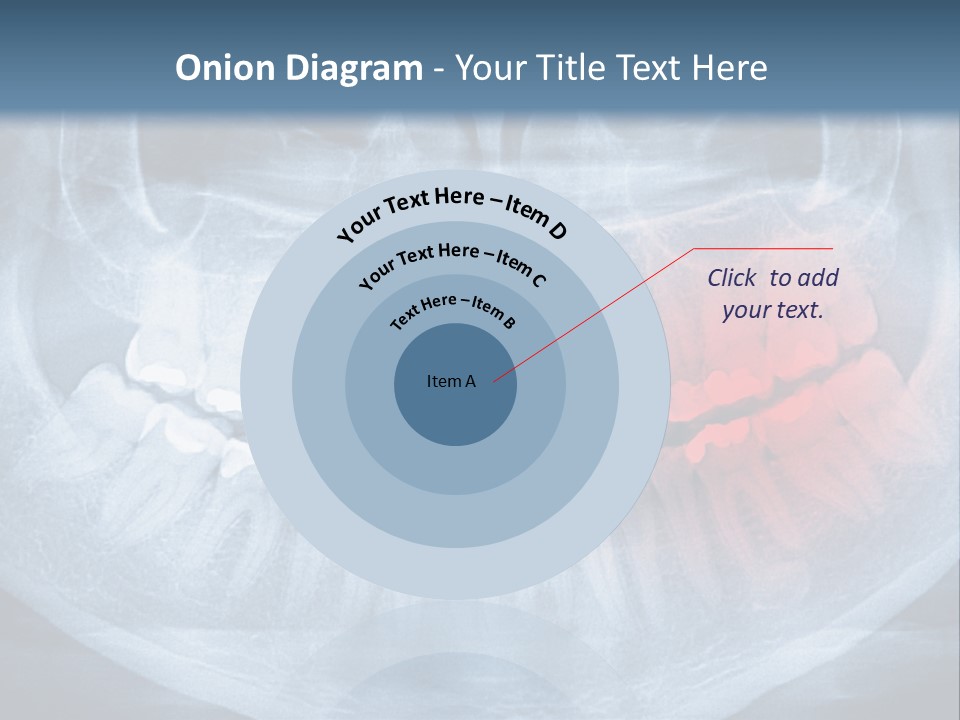 An X - Ray Of A Man's Teeth With A Red Spot In The PowerPoint Template