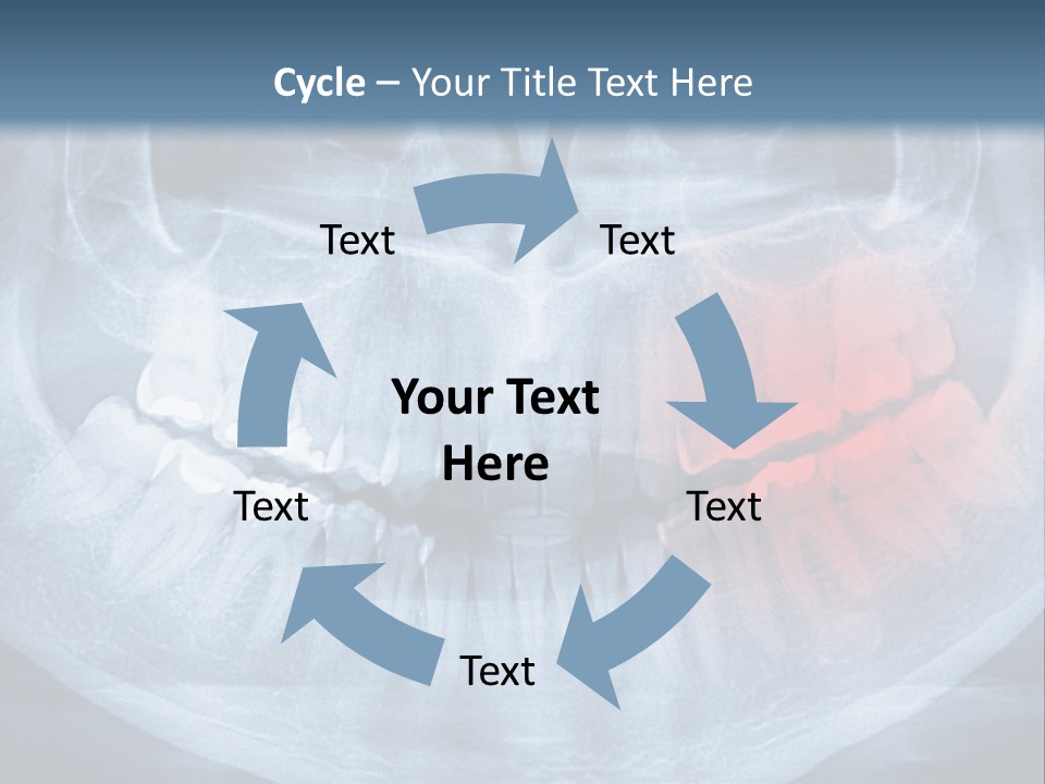 An X - Ray Of A Man's Teeth With A Red Spot In The PowerPoint Template