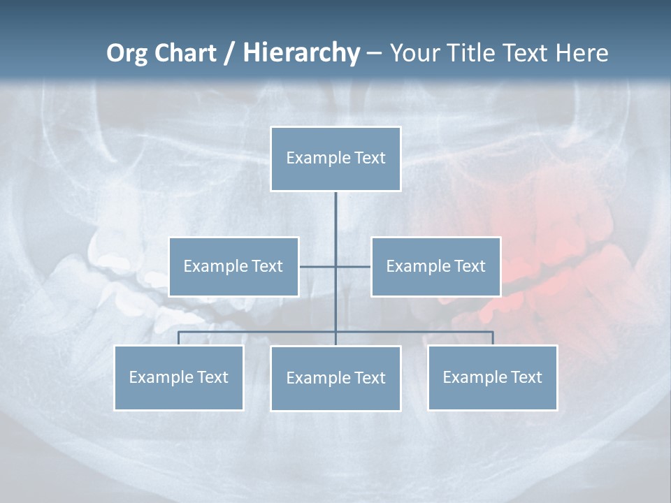 An X - Ray Of A Man's Teeth With A Red Spot In The PowerPoint Template