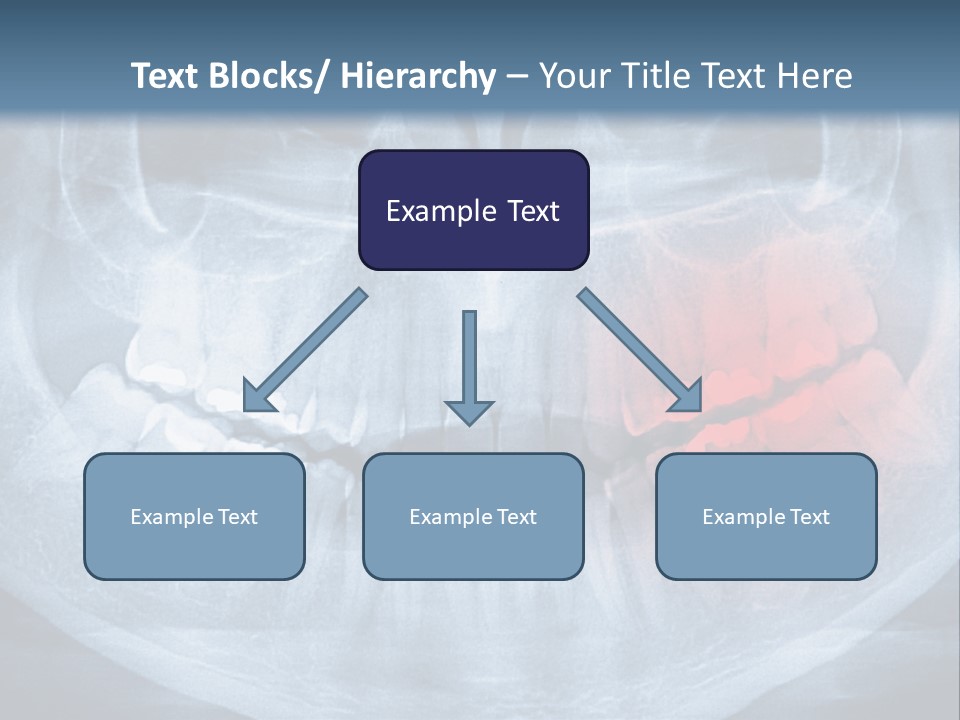 An X - Ray Of A Man's Teeth With A Red Spot In The PowerPoint Template