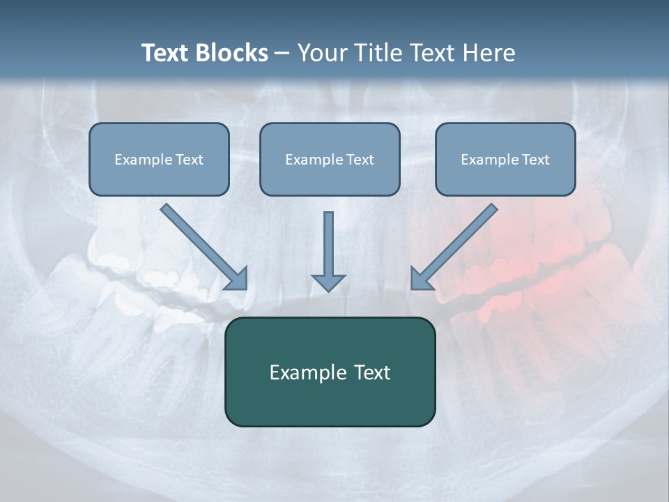 An X - Ray Of A Man's Teeth With A Red Spot In The PowerPoint Template