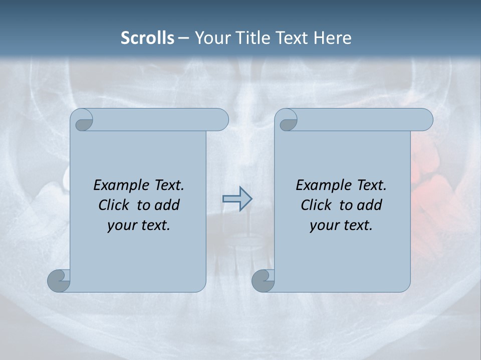 An X - Ray Of A Man's Teeth With A Red Spot In The PowerPoint Template