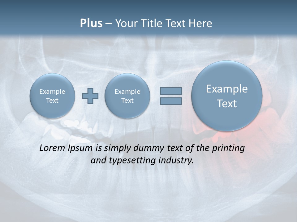 An X - Ray Of A Man's Teeth With A Red Spot In The PowerPoint Template