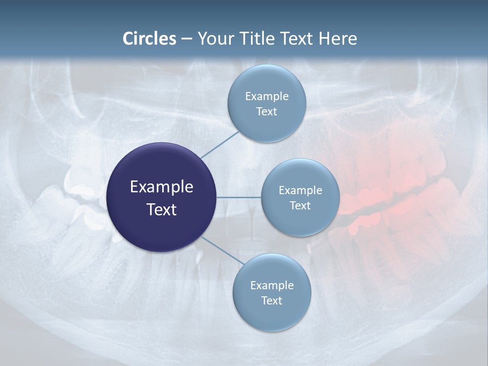 An X - Ray Of A Man's Teeth With A Red Spot In The PowerPoint Template
