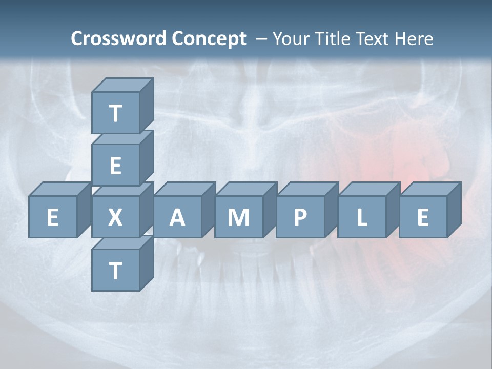 An X - Ray Of A Man's Teeth With A Red Spot In The PowerPoint Template