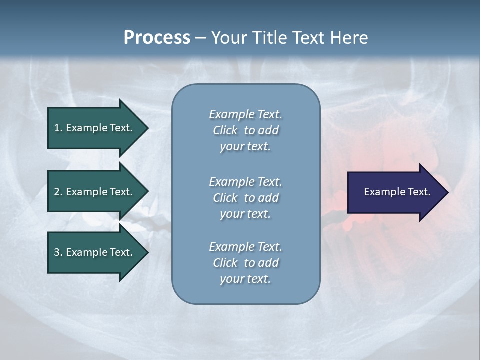 An X - Ray Of A Man's Teeth With A Red Spot In The PowerPoint Template