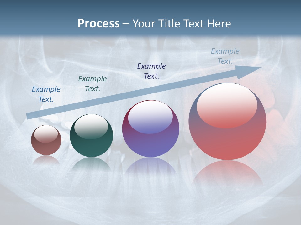 An X - Ray Of A Man's Teeth With A Red Spot In The PowerPoint Template