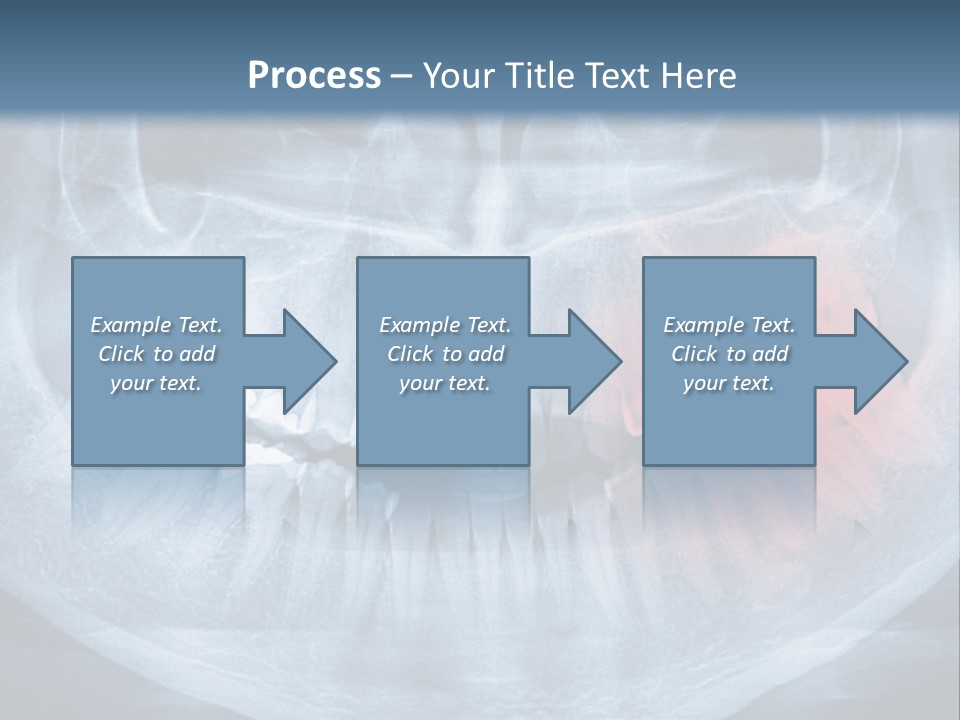 An X - Ray Of A Man's Teeth With A Red Spot In The PowerPoint Template