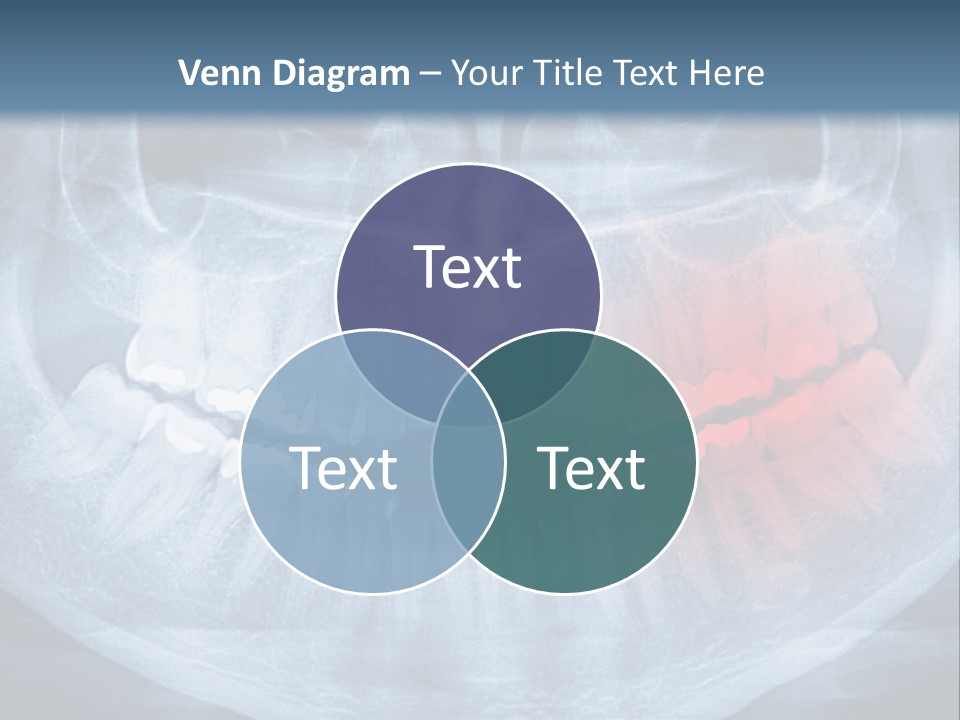 An X - Ray Of A Man's Teeth With A Red Spot In The PowerPoint Template