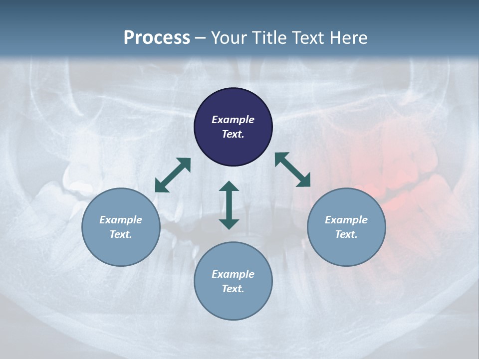 An X - Ray Of A Man's Teeth With A Red Spot In The PowerPoint Template