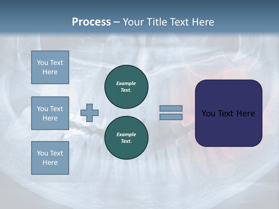 An X - Ray Of A Man's Teeth With A Red Spot In The PowerPoint Template