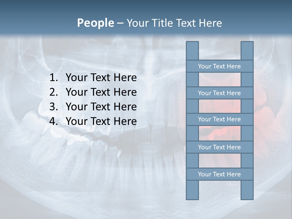 An X - Ray Of A Man's Teeth With A Red Spot In The PowerPoint Template
