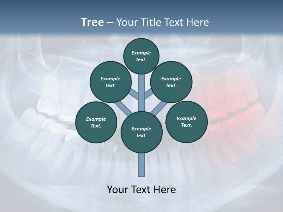 An X - Ray Of A Man's Teeth With A Red Spot In The PowerPoint Template
