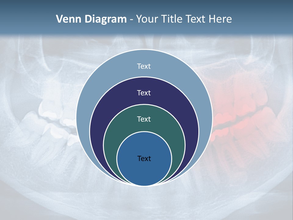 An X - Ray Of A Man's Teeth With A Red Spot In The PowerPoint Template