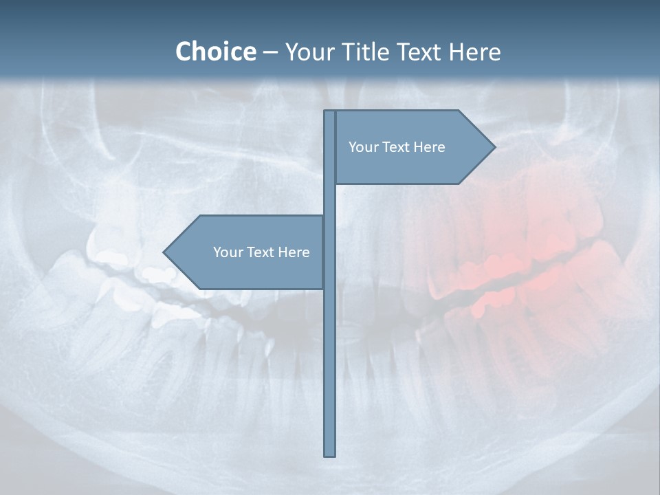 An X - Ray Of A Man's Teeth With A Red Spot In The PowerPoint Template