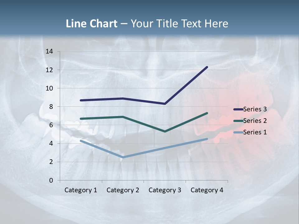 An X - Ray Of A Man's Teeth With A Red Spot In The PowerPoint Template