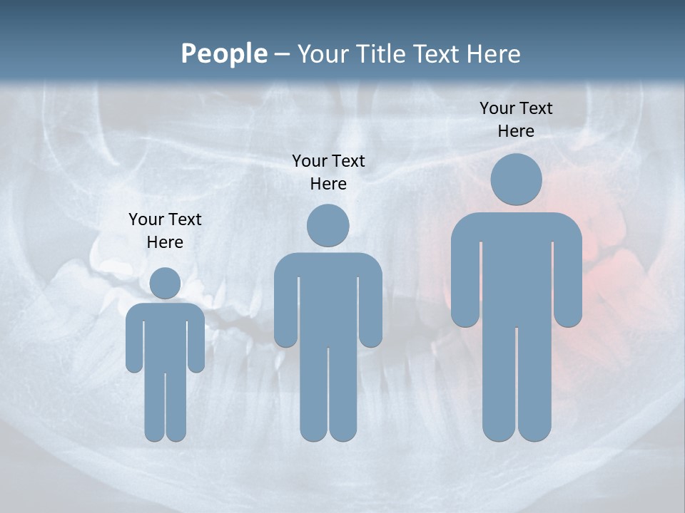 An X - Ray Of A Man's Teeth With A Red Spot In The PowerPoint Template