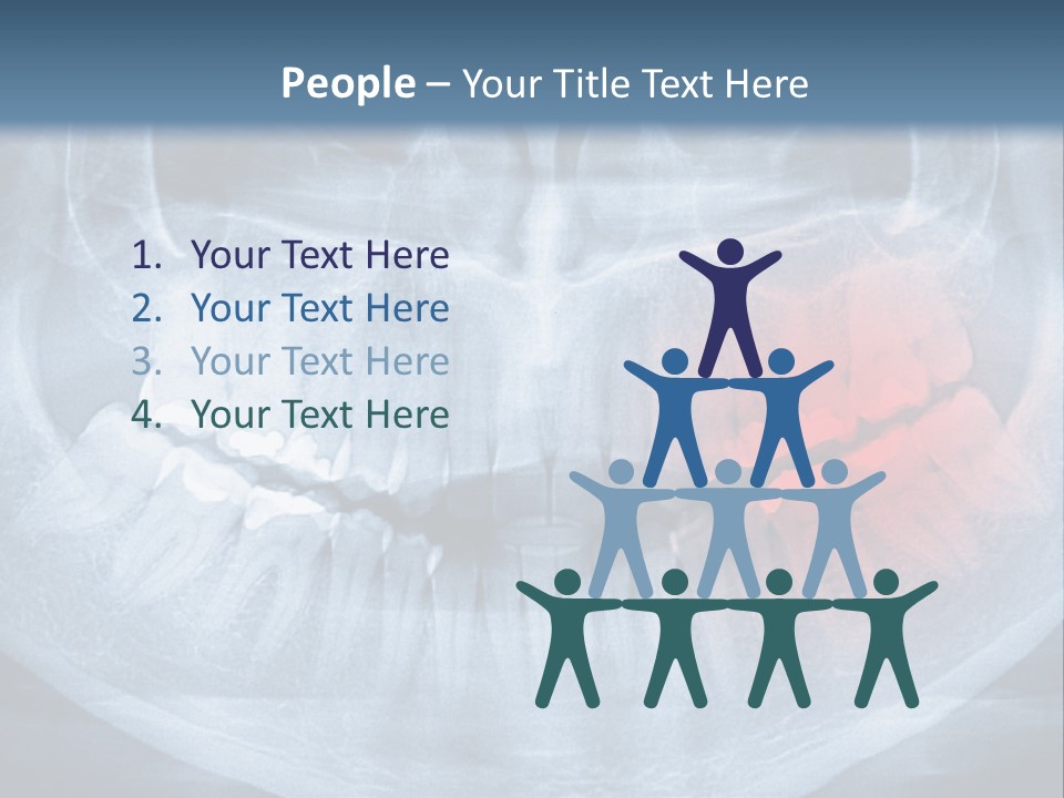 An X - Ray Of A Man's Teeth With A Red Spot In The PowerPoint Template