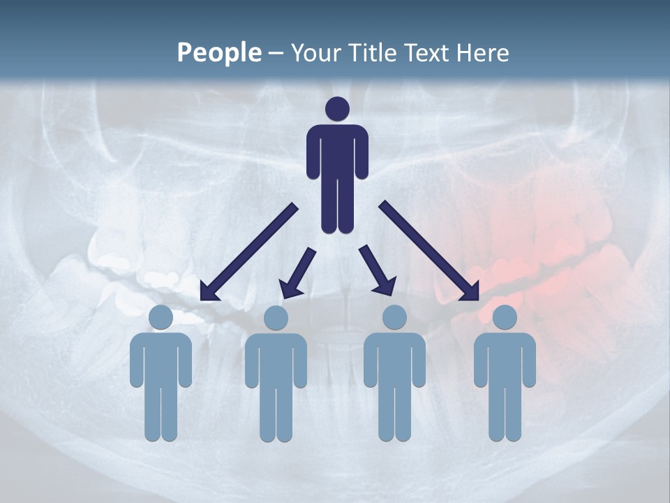 An X - Ray Of A Man's Teeth With A Red Spot In The PowerPoint Template