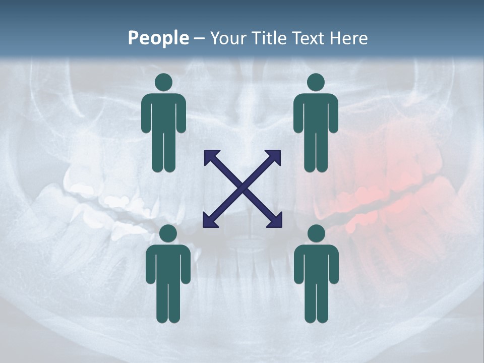 An X - Ray Of A Man's Teeth With A Red Spot In The PowerPoint Template