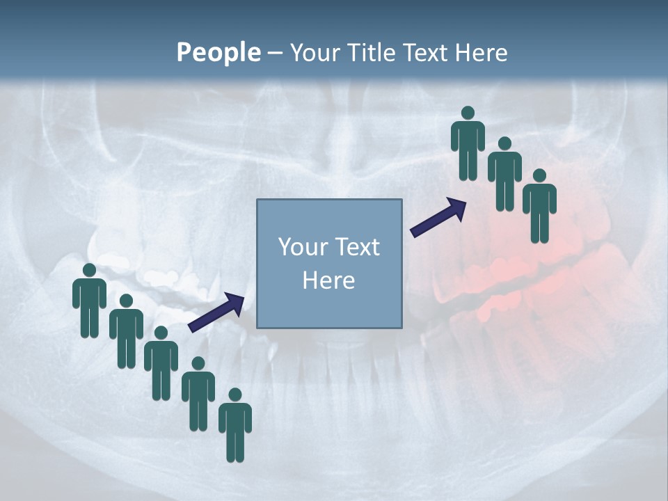 An X - Ray Of A Man's Teeth With A Red Spot In The PowerPoint Template